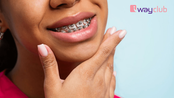 Răng vẩu có di truyền không? Giải pháp khắc phục - Iway Club