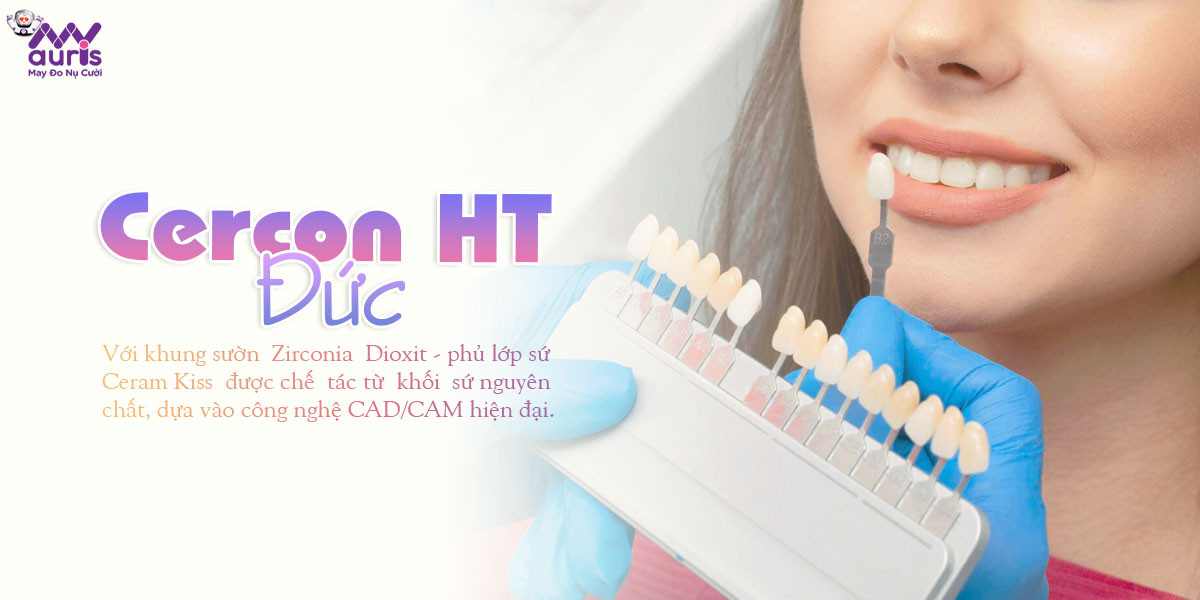 Răng sứ Cercon HT Đức - Lựa chọn qua 2 bảng màu chính - Nha Khoa My Auris