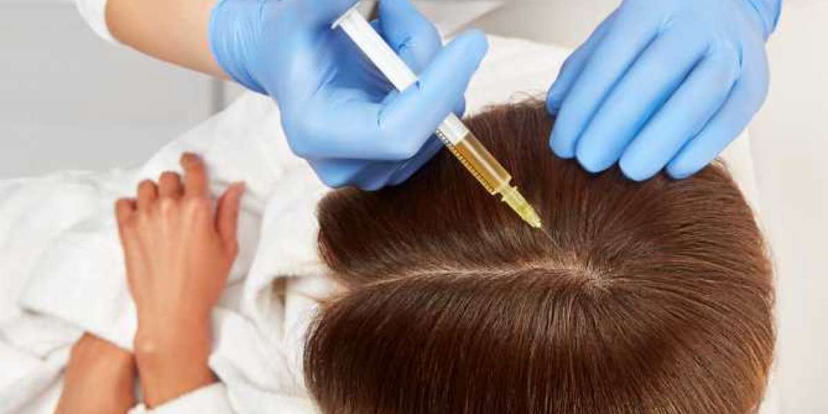 Restore Your Hair with PRP and GFC Hair Treatment