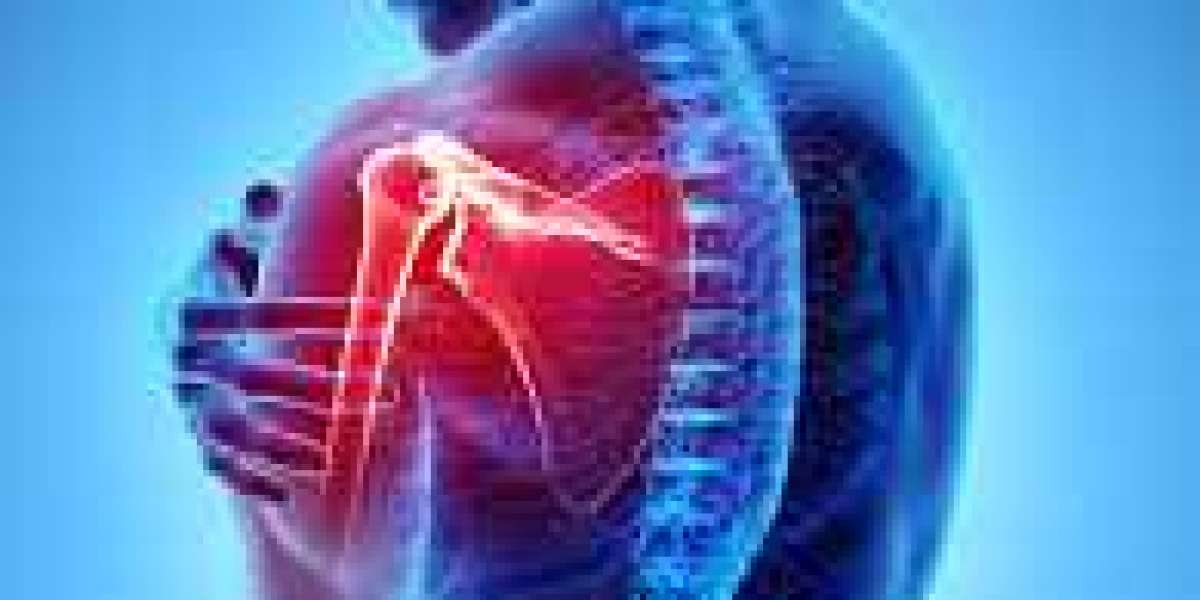 Is Tapady 200 mg Available Without Prescription?
