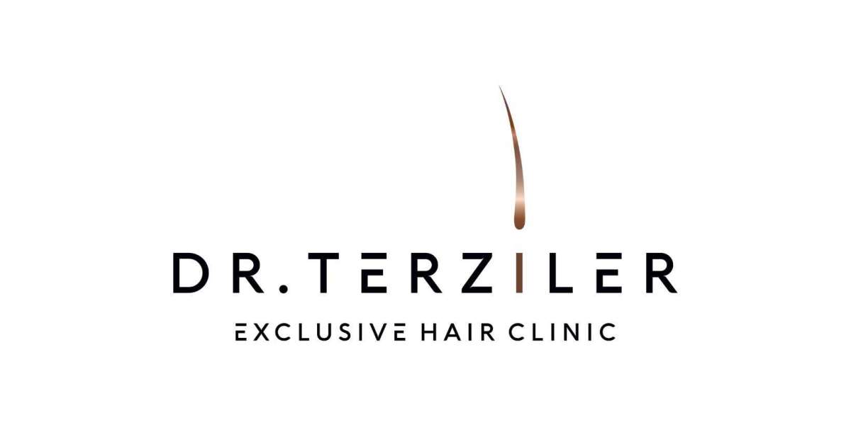 Before and After: Real Results of Dr. Terziler's Hair Transplant Procedures