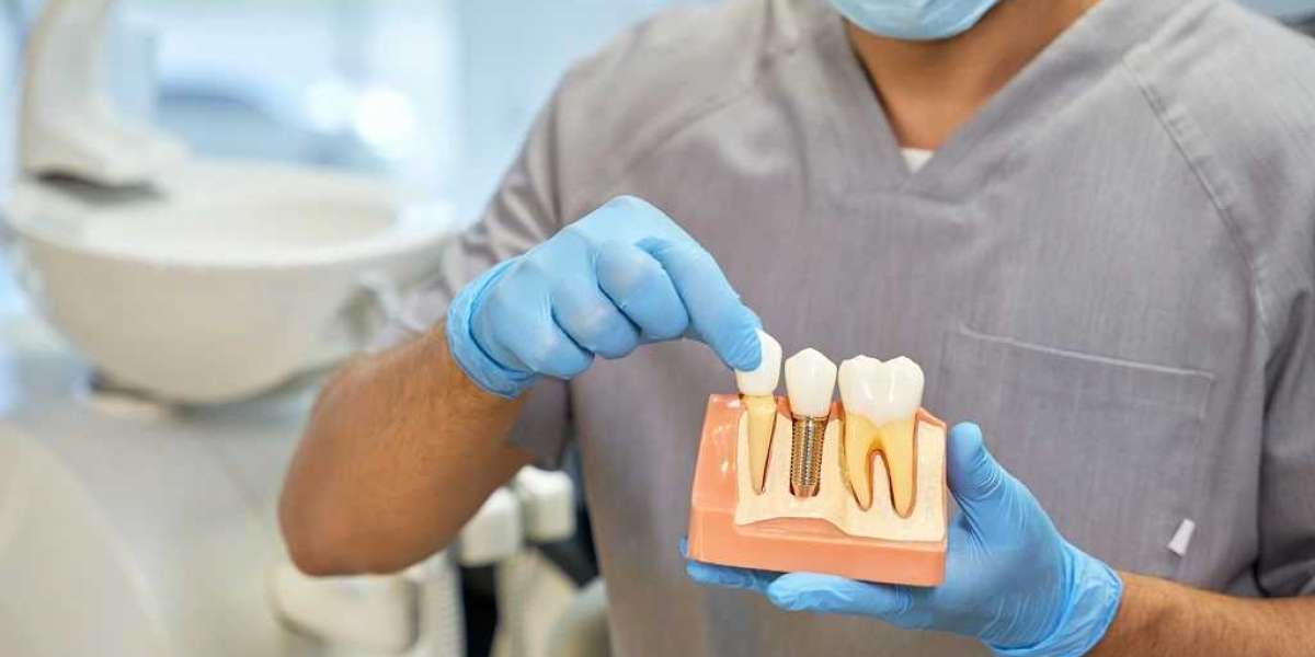 Retrieve Any Self-esteem by means of Low-priced Dental Implants in Darwin