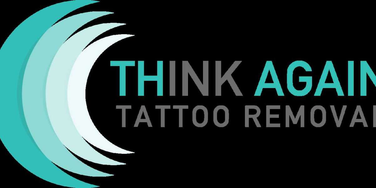 The Complete Guide to Laser Tattoo Removal